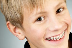 ms-blog_proper-brushing-with-braces-2